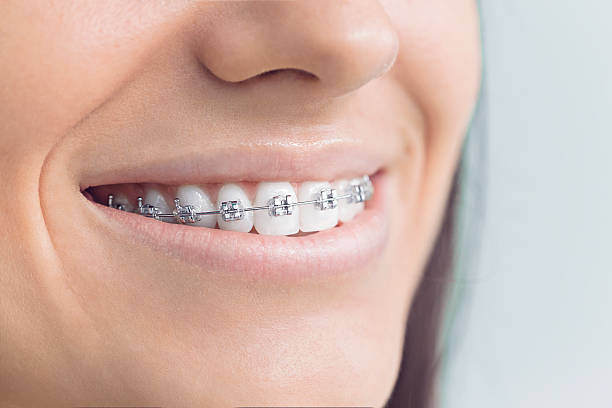 Why Choose Us for Your Dental Needs in Winston Salem, NC